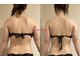 リンネ(Linne)の写真/体重ではなく、ラインを変える。今年こそ「隠す二の腕」を卒業しませんか？二の腕引き締め、スッときれい♪