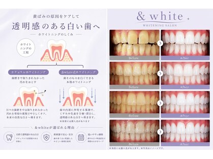 アンドホワイト 八日市店(&white)の写真