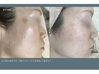 ミレラ(Mirela)の写真/今あるシミも未来のシミも徹底ケア。高濃度ビタミンＣで透明感を底上げし、揺るがない若々しい素肌へ＊
