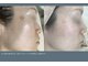 ミレラ(Mirela)の写真/今あるシミも未来のシミも徹底ケア。高濃度ビタミンＣで透明感を底上げし、揺るがない若々しい素肌へ＊