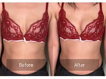 ハートランド(HEARTLAND)/プチクレオパトラ☆1回の施術