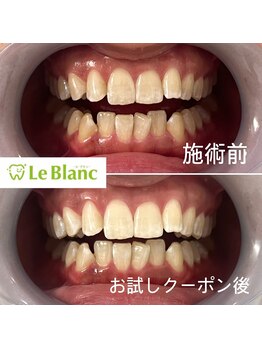 ルブラン 奈良店(Le Blanc)/まずは体験してみてください♪