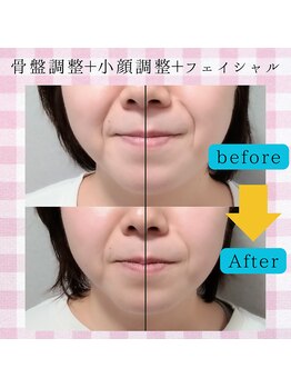 カイロプラクティックそらいろ/たるみ、ほうれい線を徹底ケア