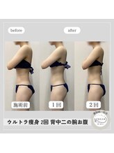 カラー(CALLA)/華奢魅せ☆二の腕と背中くびれ