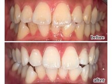 トミー(TOMMY)/【ビフォーアフター】