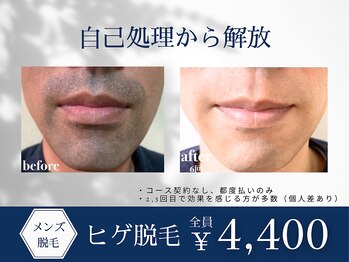 サッカ 新栄店(sacca)/≪メンズヒゲ脱毛≫