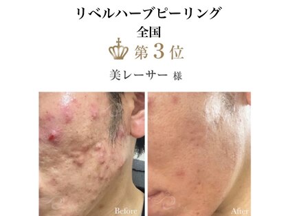 美レーサー(Bellezza)の写真