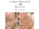 美レーサー(Bellezza)の写真