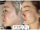ティアラ(TIARA)の写真