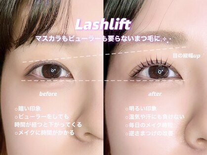 ルナ(Luna)の写真