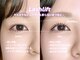 ルナ(Luna)の写真