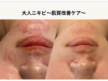 オートクチュール エステティックサロン シーズの写真