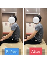 ナオル整体 宮崎院(NAORU整体)/30代男性施術事例【猫背改善】