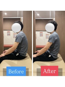 ナオル整体 宮崎院(NAORU整体)/30代男性施術事例【猫背改善】