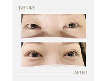 マーブル(marble)の雰囲気(目元のリフトアップ♪眼精疲労の方にもオススメです!)