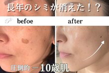 パールホワイトニングサロン 大船店