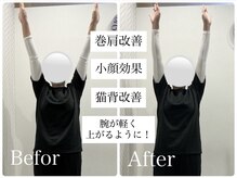 ユルル 刈谷店(Yururu)/before・after（骨盤猫背整体）