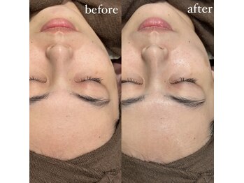 イロドリ(IRODORI)の写真/お肌にハリとツヤ感を！くすみのないクリアな素肌へ。都度払いで気軽に通えるエステサロン◎