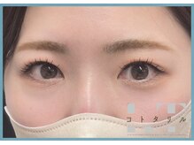 コトタリル/LEDマツエク