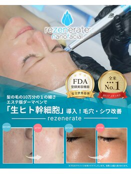 マリナビューティーサロン(Malina BEAUTY SALON)の写真/【★生ヒト幹細胞導入】毛穴レス韓国艶肌に！◎エステ版ダーマ・リゼネレートでナノレベルの肌質改善