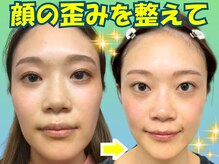 ナチュラルビューティーフェイス 横浜(NBF)