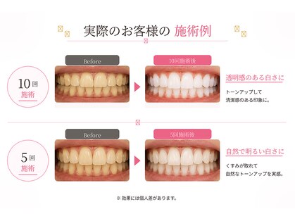 ホワイトニングショップ 柏店の写真
