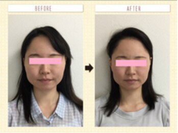 美容整体ウェリナ あま甚目寺院/小顔矯正/骨盤矯正/美脚サロン