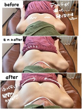 つばききよら/バストのボリュームのお悩み