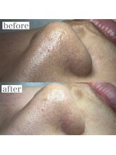 ライカブルー(RaicA BluE)/施術写真　before-after