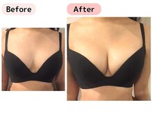 ピーグランディ 栄店(p-Grandi)/【お悩み】バスト離れ・離れ乳