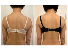 美人バスト 小倉店/バストアップ◇症例◇体型の変化