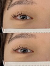 ロバスト(ROBUST)