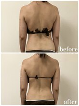 リリィブラン(Lily branc)/痩身/背中+腰ウエスト