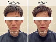 ハリラウンジ 恵比寿本店(Hari Lounge)/美容鍼専門サロン Hari Lounge