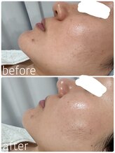 グレイス アンド ミューズ(grace&muse)/《クリスティーナ》ビオフィート