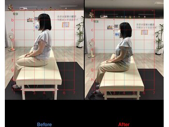 ストレチックス 近江八幡店/姿勢改善ビフォーアフター1回