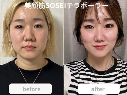 アオダモ(aodamo)の写真