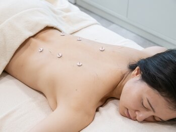 マグノリアの写真/【10年以上の実績!辛い凝り疲れに定評あり】あなたの不調の原因を診断しながら根本から見直す鍼灸コース◎