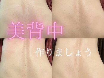 ゾーンビューティーハウス 松戸店(ZONE BEAUTY HOUSE)/お背中のケア ★ブライダルも♪