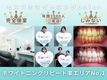 ドルチェ 水戸店(Dolce)の雰囲気（医療提携導入キャンペーン!!２照射30分のセルフホワイトニング★）