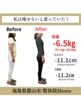 整体院 モンテ(monte)/before＆after
