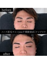 ユー 千葉駅前店(you)/ビフォ－アフター写真