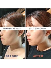 カウピリ(kaupili)/レモンボトル◇ビフォーアフター