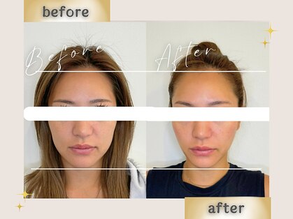 整え屋 レッド(RED)の写真