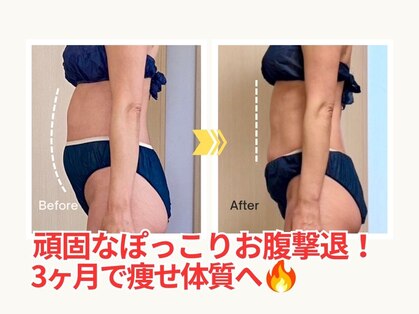 ミービレイ(Mie美戻)の写真