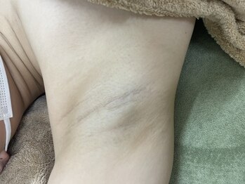 ナノハナ/鹿沼市全身脱毛美容室ナノハナ