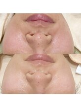 ルコア ドゥ(rucor doux)/乾燥知らずのお肌へ☆