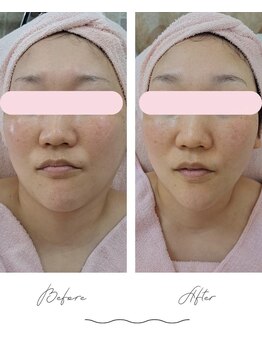 リアウェイク(Reawayke)/レモンボトル1回の効果