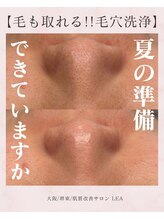 レア(Lea)/夏の準備はできていますか？＊