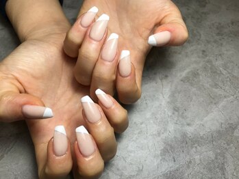 イデアル(ideal)/スカルプオーバーレイ